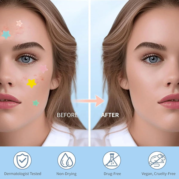 Multi-Size Star Acne Patches: Adorable Blemish Cover, Conceals Pimples & Scars. Gentle & Breathable for All-Day Wear.