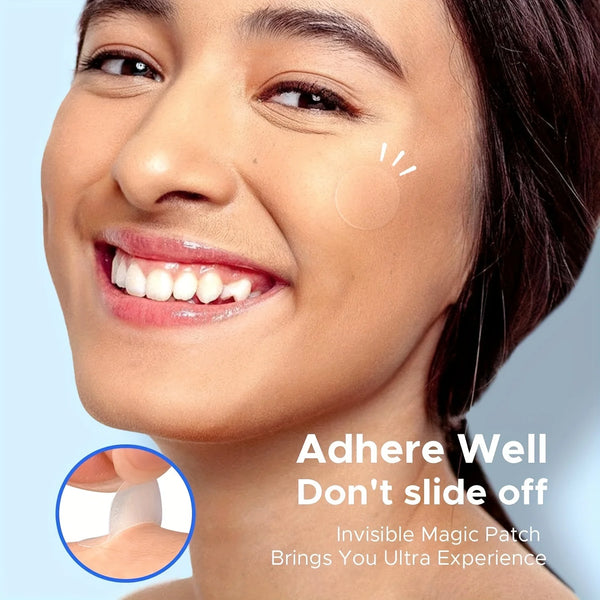 "720pcs Tea Tree Acne Patches with Salicylic Acid Invisible Waterproof for Day & Night Use, Alcohol-Free, All Skin Types"