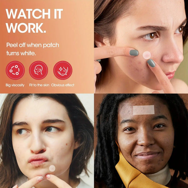 195 hydrocolloid acne patches - alcohol free, odorless, non irritating, and effective in removing acne patches